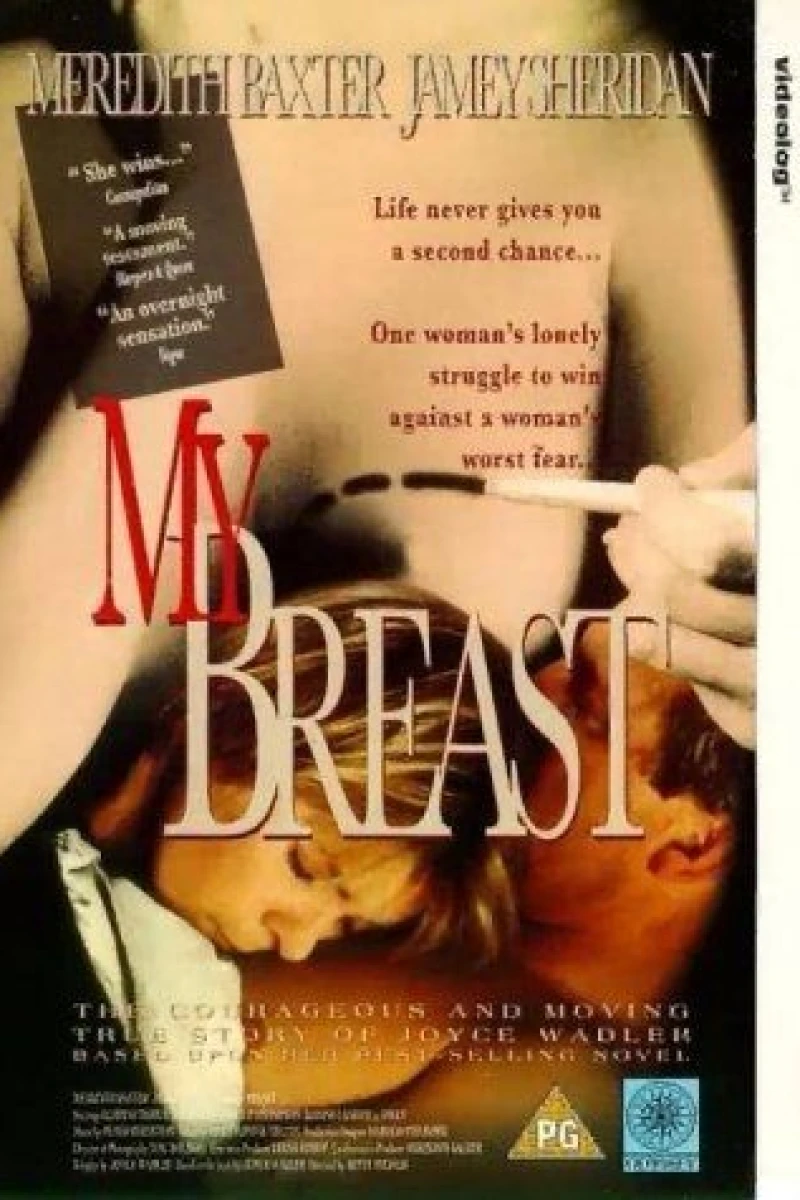 My Breast Poster