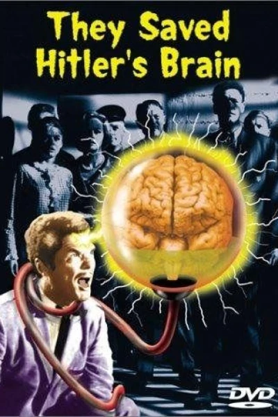 They Saved Hitler's Brain