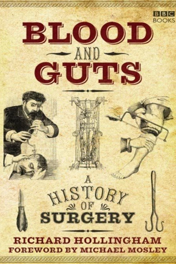 Blood and Guts: A History of Surgery Poster